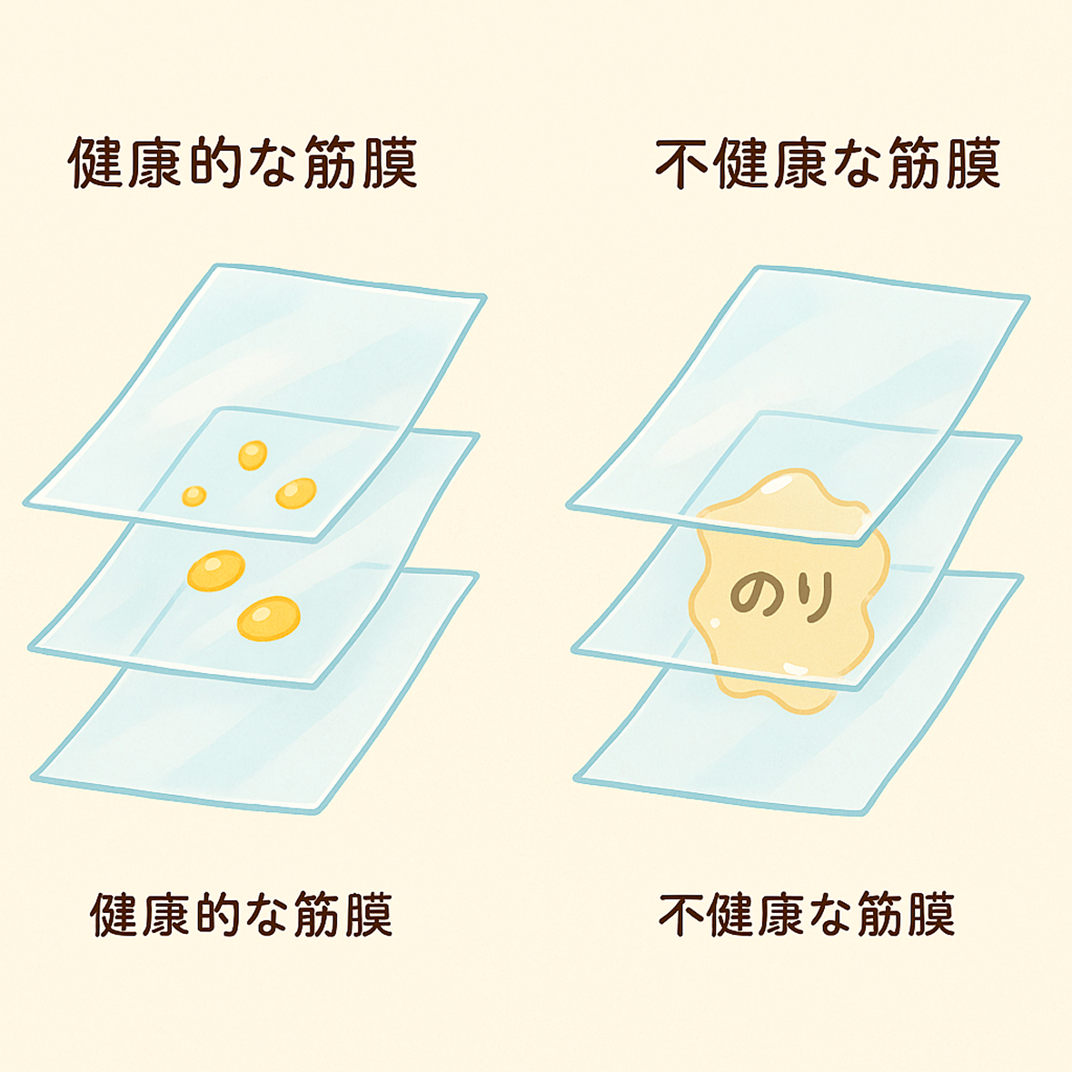 健康な筋膜の図